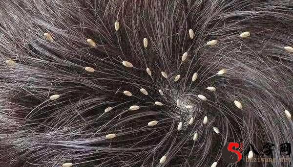 梦到孩子身上好多虱子