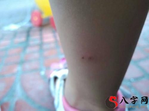 梦到被小老鼠咬腿