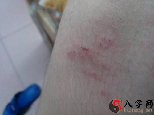 梦到被老鼠咬腿