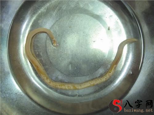 梦到从腿上拔出寄生虫