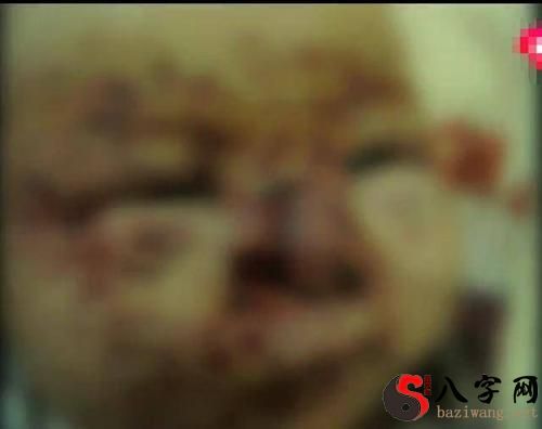 梦到被老鼠咬脸