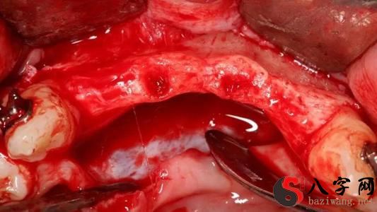 梦到月经血弄到被子上