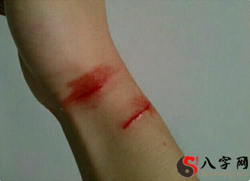 梦到伤口流血