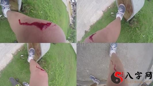 梦到摔跤流血了