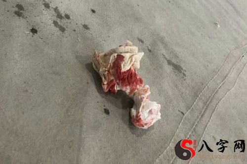 梦到头部受伤流血