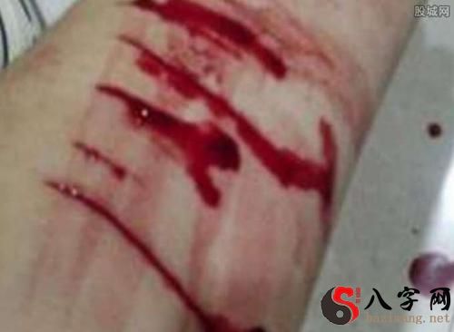 梦到手心流血