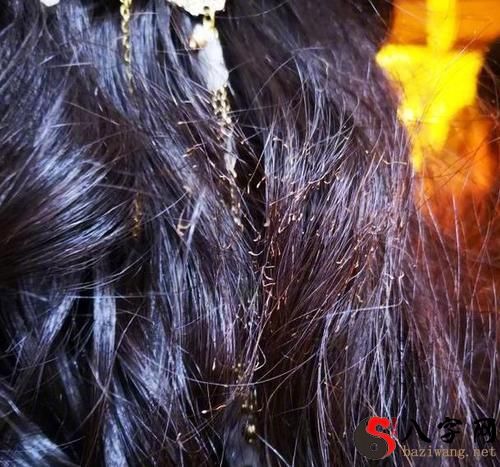 梦到头发被火烧