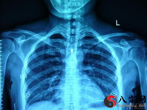梦到照X光